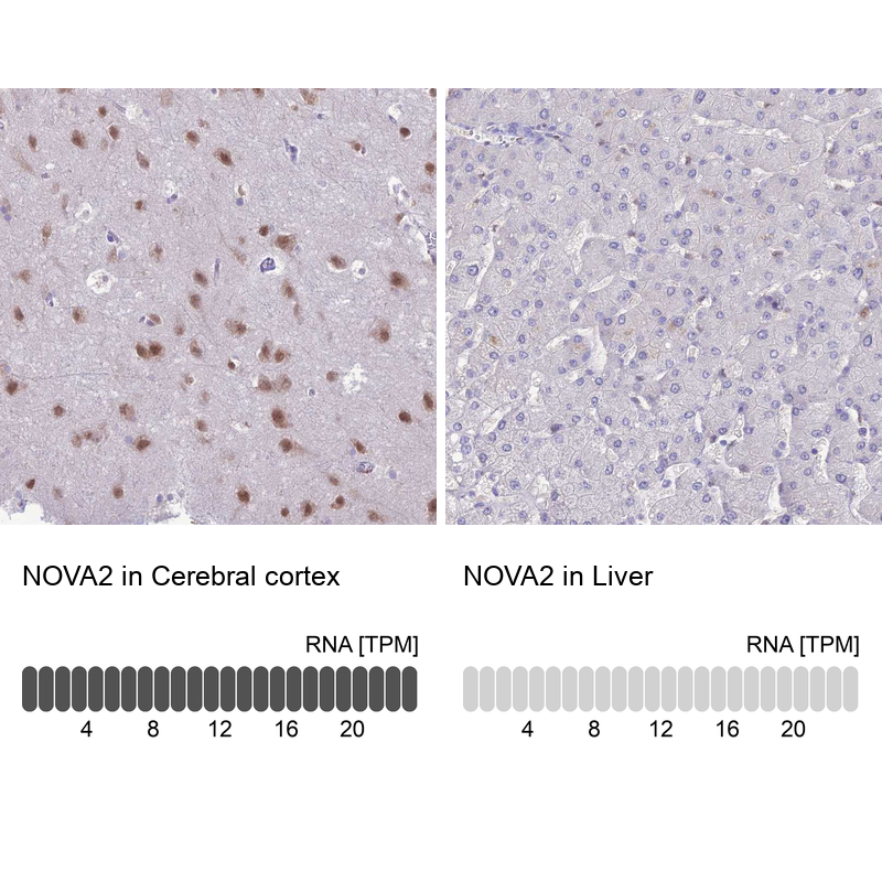 Nova2 Antibody - BSA Free Immunohistochemistry: Nova2 Antibody - BSA Free [NBP1-92196]