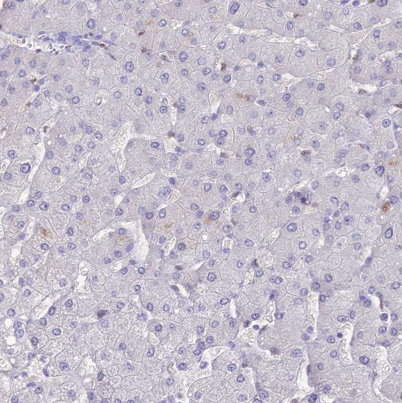 Nova2 Antibody - BSA Free Immunohistochemistry: Nova2 Antibody - BSA Free [NBP1-92196]