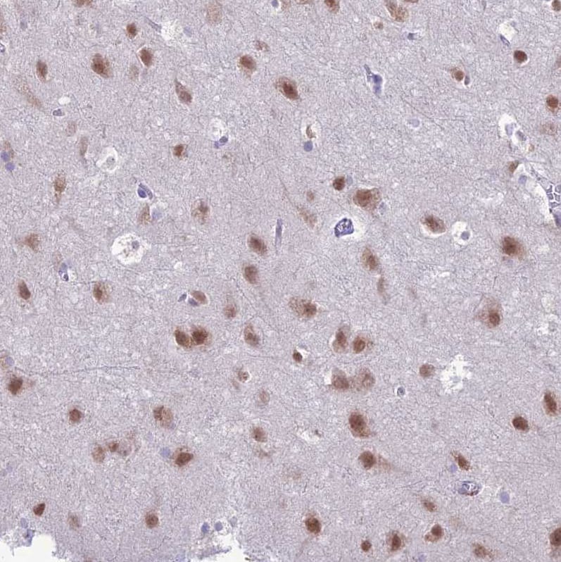 Nova2 Antibody - BSA Free Immunohistochemistry: Nova2 Antibody - BSA Free [NBP1-92196]