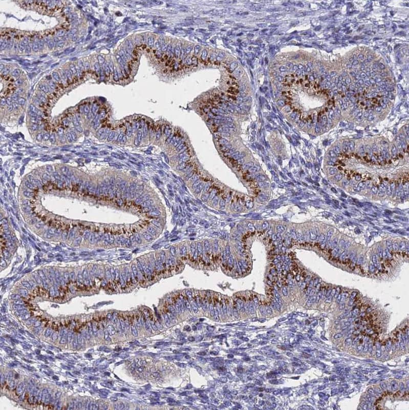 NSUN6 Antibody - BSA Free Immunohistochemistry: NSUN6 Antibody - BSA Free [NBP1-92202]