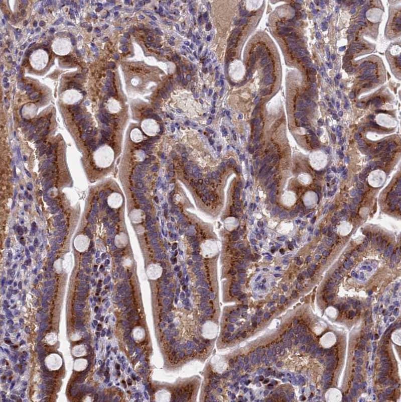 NSUN6 Antibody - BSA Free Immunohistochemistry: NSUN6 Antibody - BSA Free [NBP1-92202]