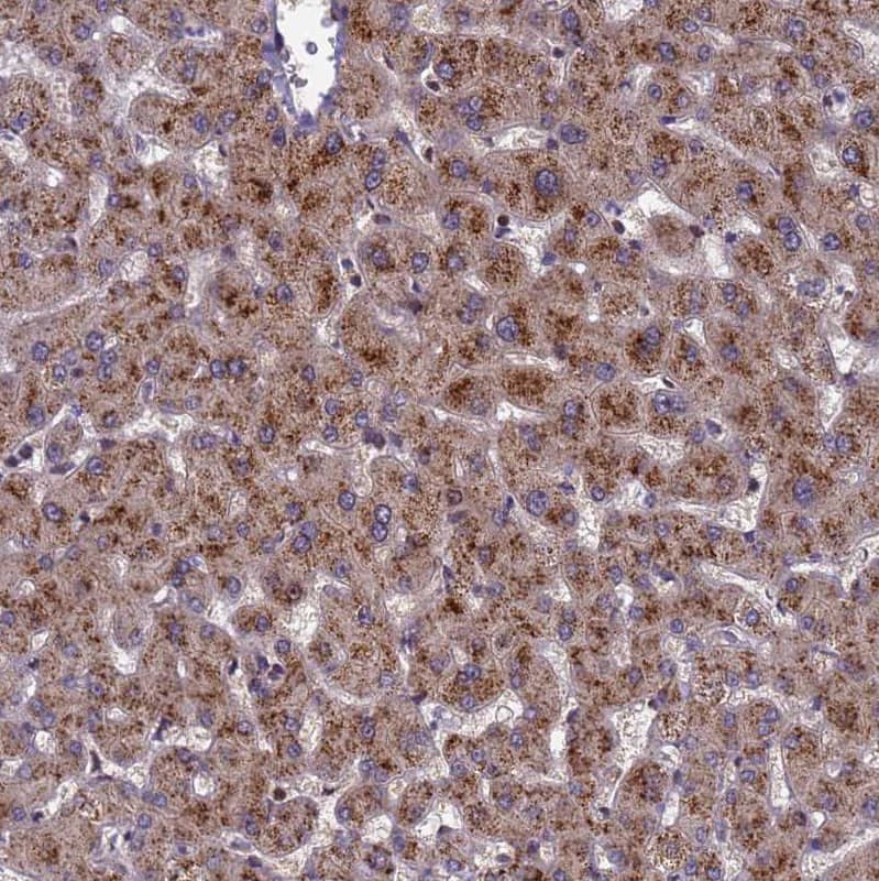 NSUN6 Antibody - BSA Free Immunohistochemistry: NSUN6 Antibody - BSA Free [NBP1-92202]