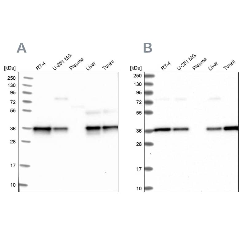 NUBP1 Antibody - BSA Free Western Blot: NUBP1 Antibody - BSA Free [NBP1-92205]
