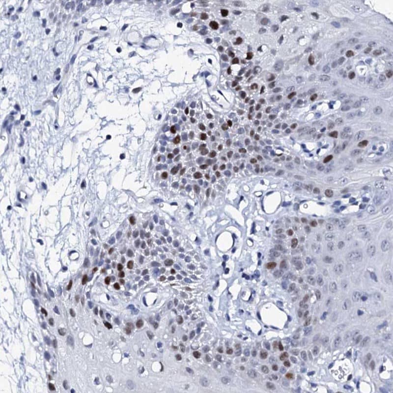 NUDT13 Antibody - BSA Free Immunohistochemistry-Paraffin: NUDT13 Antibody [NBP1-92207]