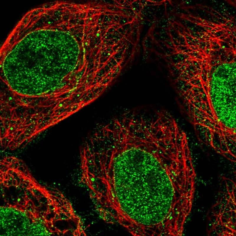 Nup53 Antibody - BSA Free Immunocytochemistry/ Immunofluorescence: Nup53 Antibody [NBP1-92214]