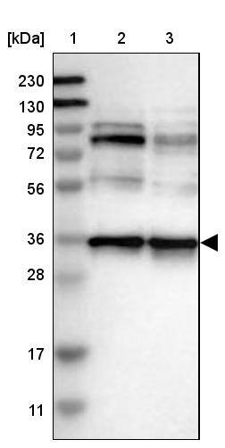 Nup53 Antibody - BSA Free Western Blot: Nup53 Antibody - BSA Free [NBP1-92214]