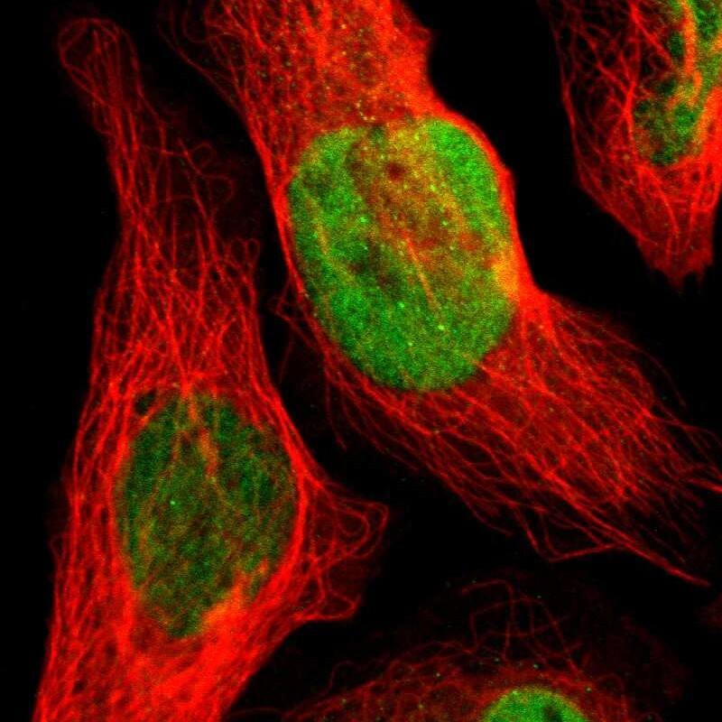 Ocular development associated gene Antibody - BSA Free Immunocytochemistry/ Immunofluorescence: Ocular development associated gene Antibody [NBP1-92219]