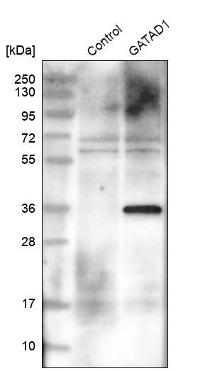 Ocular development associated gene Antibody - BSA Free Western Blot: Ocular development associated gene Antibody - BSA Free [NBP1-92219]