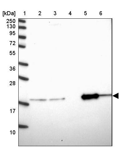 OPA3 Antibody - BSA Free Western Blot: OPA3 Antibody - BSA Free [NBP1-92221]