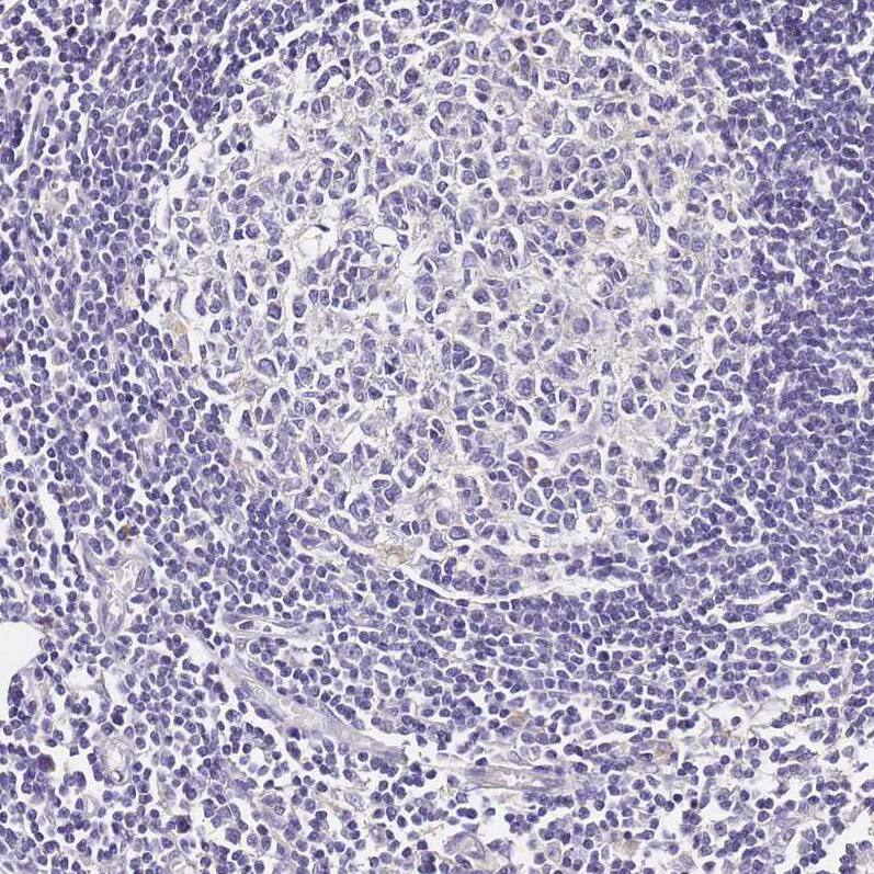 OR2B11 Antibody - BSA Free Immunohistochemistry: OR2B11 Antibody - BSA Free [NBP1-92225]