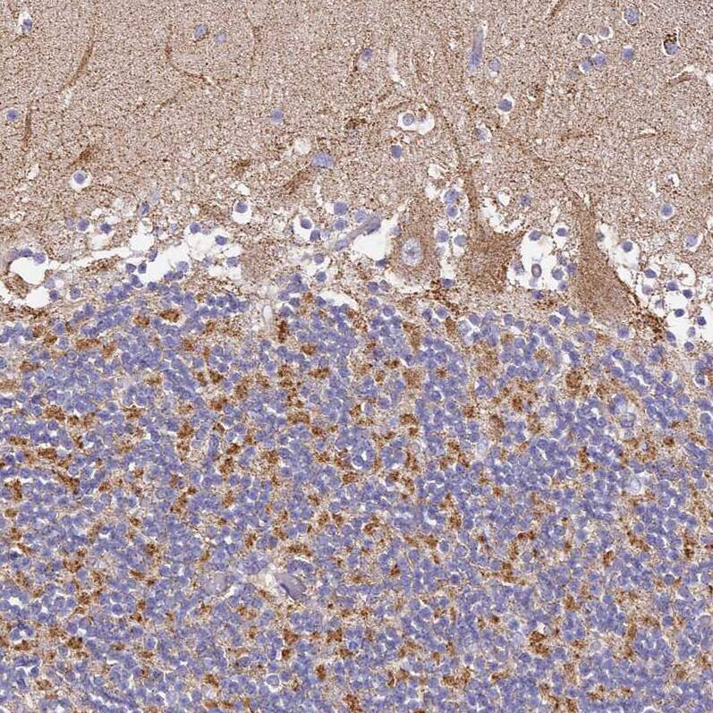 OR2B11 Antibody - BSA Free Immunohistochemistry: OR2B11 Antibody - BSA Free [NBP1-92225]