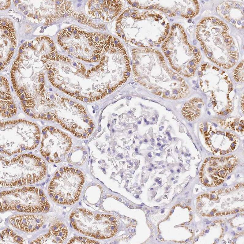 OR2B11 Antibody - BSA Free Immunohistochemistry: OR2B11 Antibody - BSA Free [NBP1-92225]