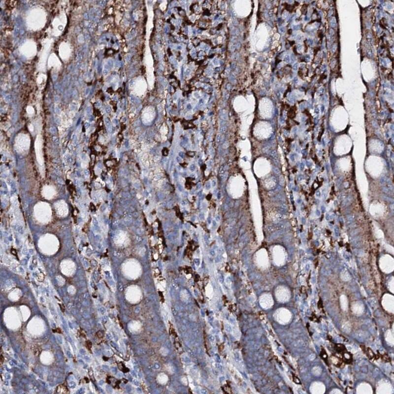 OSBPL2 Antibody - BSA Free Immunohistochemistry: OSBPL2 Antibody - BSA Free [NBP1-92236]