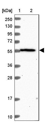 OSBPL2 Antibody - BSA Free Western Blot: OSBPL2 Antibody - BSA Free [NBP1-92236]