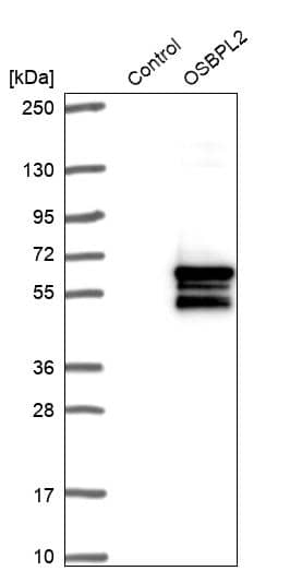 OSBPL2 Antibody - BSA Free Western Blot: OSBPL2 Antibody - BSA Free [NBP1-92237]