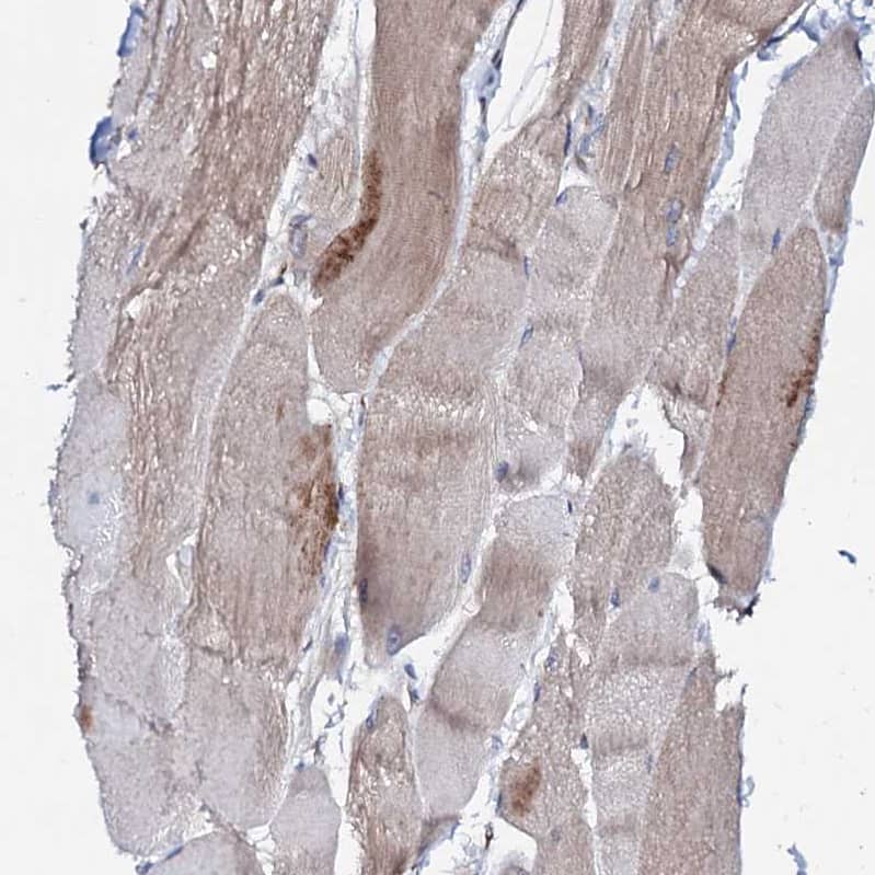 P2X4 Antibody - BSA Free Immunohistochemistry: P2X4 Antibody - BSA Free [NBP1-92239]