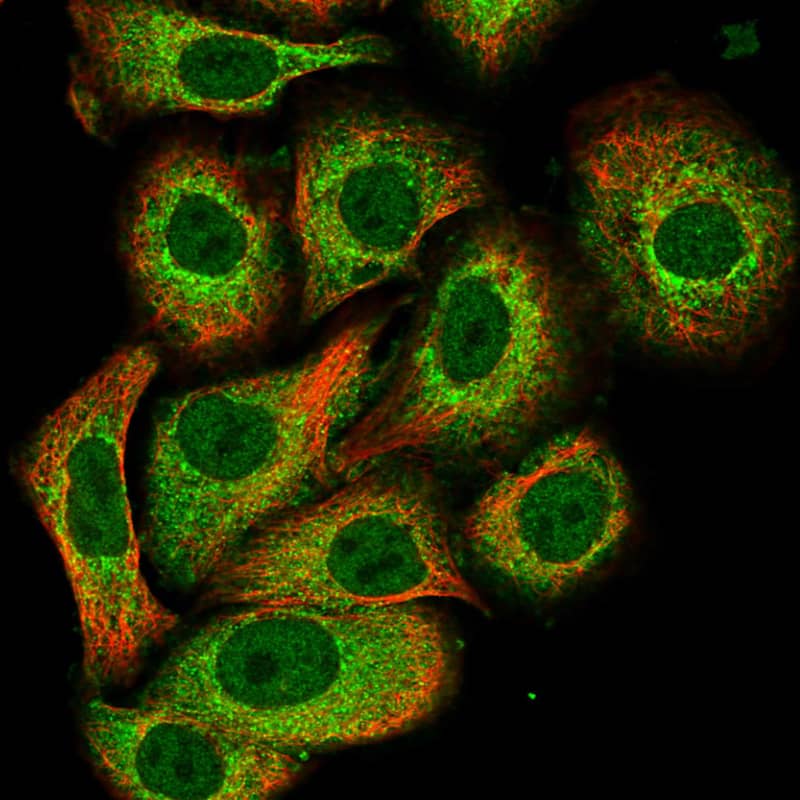 PAD3 Antibody - BSA Free Immunocytochemistry/ Immunofluorescence: PAD3 Antibody - BSA Free [NBP1-92240]