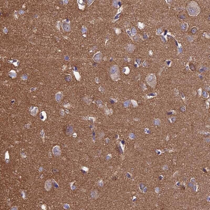 PCDHA5 Antibody - BSA Free Immunohistochemistry: PCDHA5 Antibody - BSA Free [NBP1-92244]