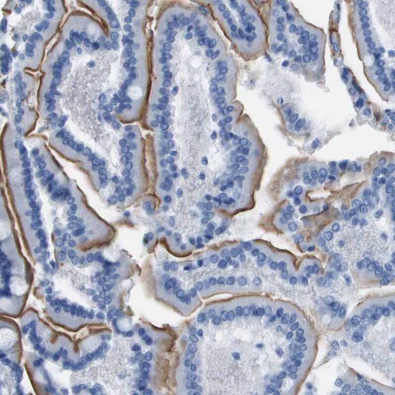 PCLKC Antibody - BSA Free Immunohistochemistry: PCLKC Antibody - BSA Free [NBP1-92247]