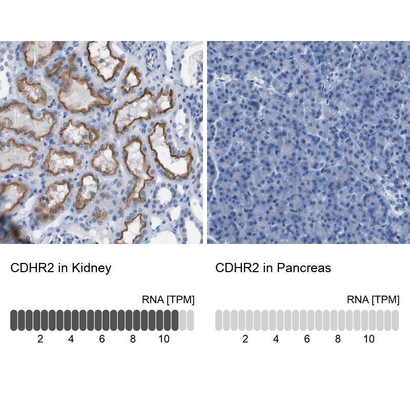 PCLKC Antibody - BSA Free Immunohistochemistry: PCLKC Antibody - BSA Free [NBP1-92247]