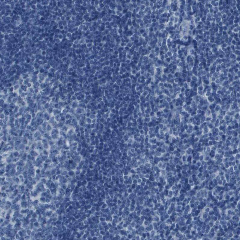 PCLKC Antibody - BSA Free Immunohistochemistry: PCLKC Antibody - BSA Free [NBP1-92247]