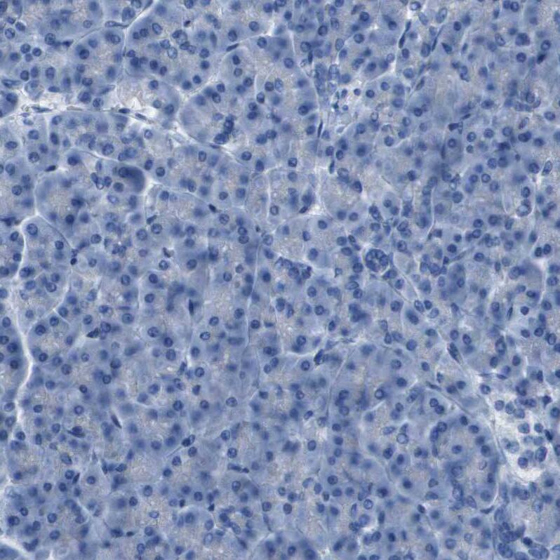 PCLKC Antibody - BSA Free Immunohistochemistry: PCLKC Antibody - BSA Free [NBP1-92247]