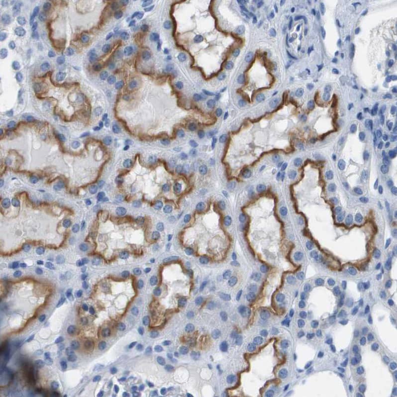 PCLKC Antibody - BSA Free Immunohistochemistry: PCLKC Antibody - BSA Free [NBP1-92247]