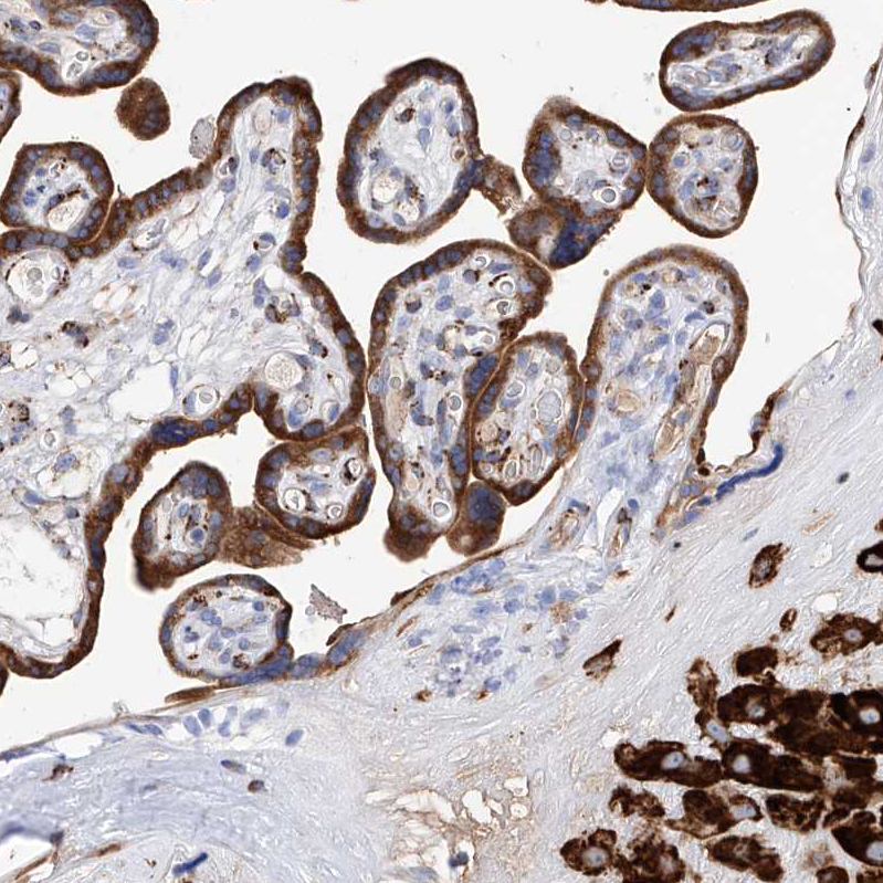 PDIR Antibody - BSA Free Immunohistochemistry: PDIR Antibody - BSA Free [NBP1-92250]