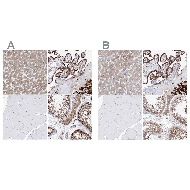 PDIR Antibody Immunohistochemistry-Paraffin: PDIR Antibody Antibody [NBP1-92252]