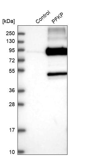 PFKP Antibody - BSA Free Western Blot: PFKP Antibody - BSA Free [NBP1-92256]