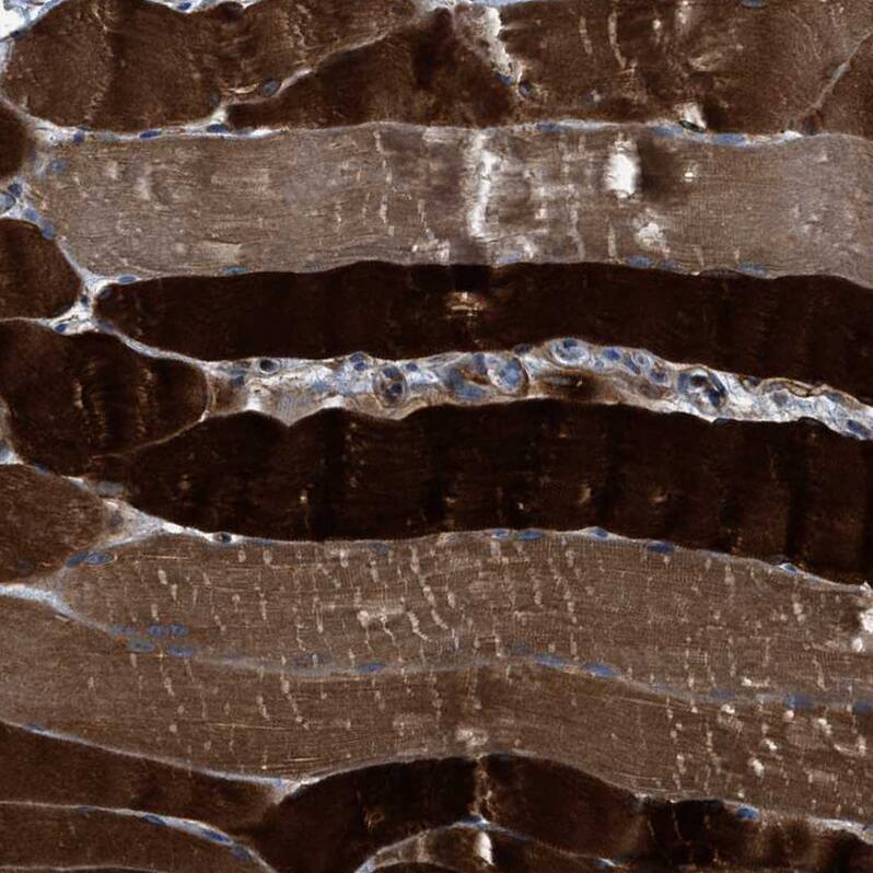 PFKP Antibody - BSA Free Immunohistochemistry: PFKP Antibody - BSA Free [NBP1-92256]