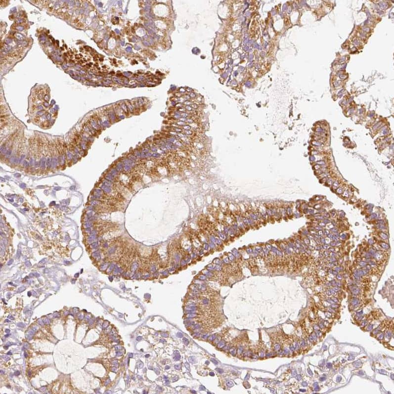 PGAM5 Antibody - BSA Free Immunohistochemistry: PGAM5 Antibody - BSA Free [NBP1-92257]