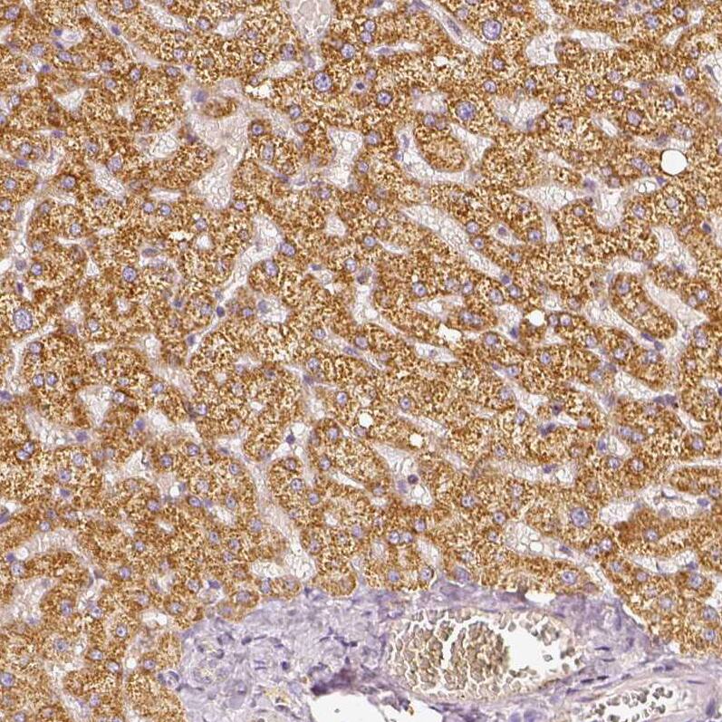 PGAM5 Antibody - BSA Free Immunohistochemistry: PGAM5 Antibody - BSA Free [NBP1-92257]