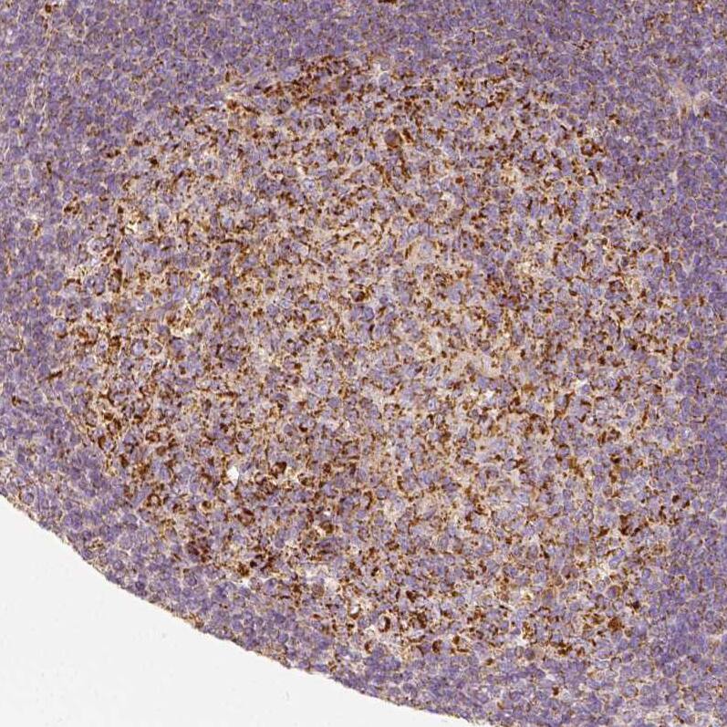 PGAM5 Antibody - BSA Free Immunohistochemistry: PGAM5 Antibody - BSA Free [NBP1-92257]