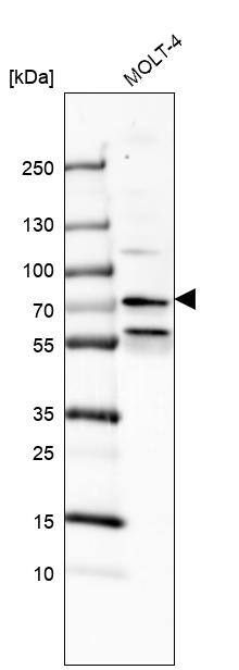 PHF22 Antibody - BSA Free Western Blot: PHF22 Antibody - BSA Free [NBP1-92263]