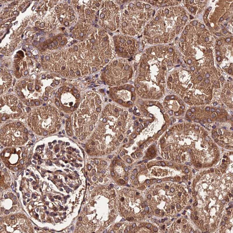 Phosphodiesterase 4D Antibody - BSA Free Immunohistochemistry: Phosphodiesterase 4D Antibody - BSA Free [NBP1-92265]