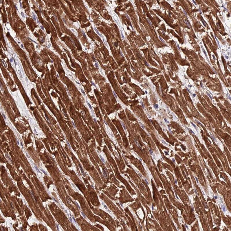 Phosphodiesterase 4D Antibody - BSA Free Immunohistochemistry: Phosphodiesterase 4D Antibody - BSA Free [NBP1-92265]