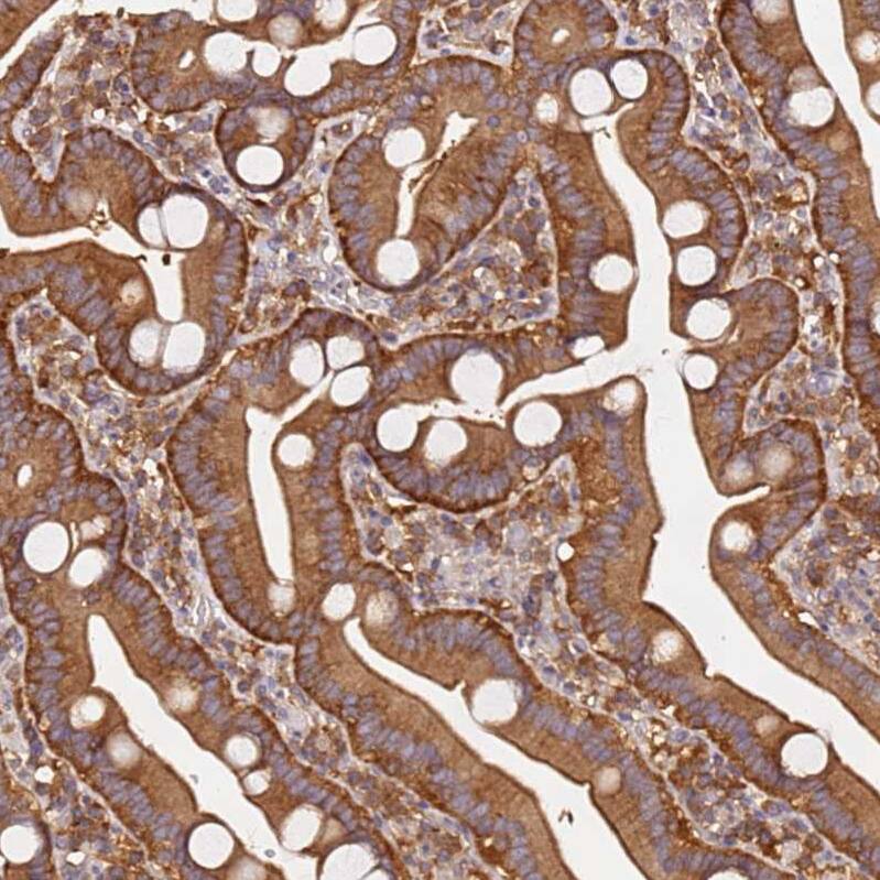 PIH1D1 Antibody - BSA Free Immunohistochemistry: PIH1D1 Antibody - BSA Free [NBP1-92269]