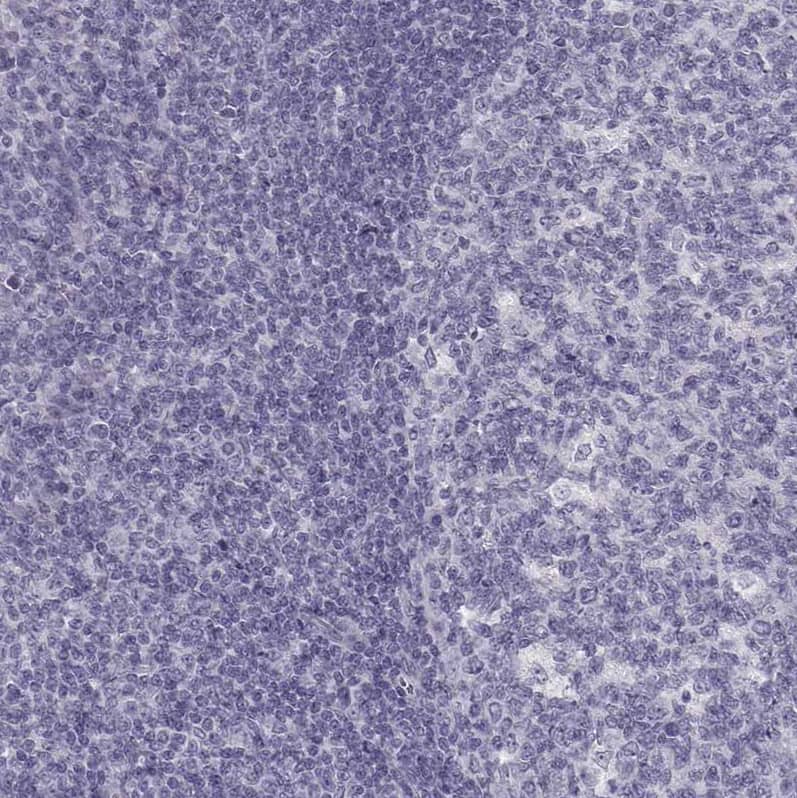 Pit1 Antibody - BSA Free Immunohistochemistry: Pit1 Antibody - BSA Free [NBP1-92273]
