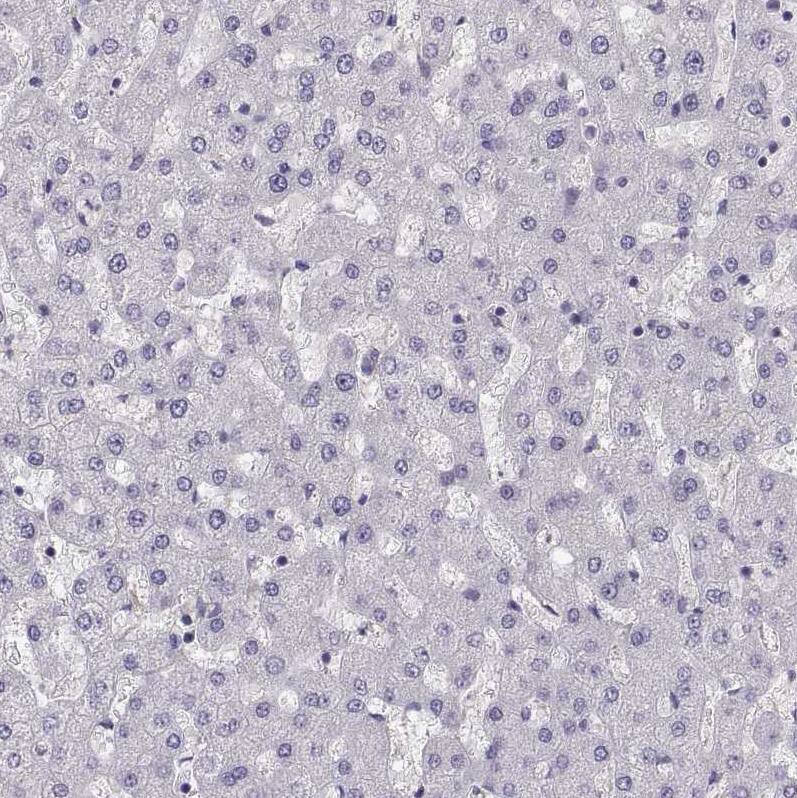Pit1 Antibody - BSA Free Immunohistochemistry: Pit1 Antibody - BSA Free [NBP1-92273]