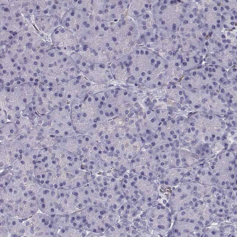 Pit1 Antibody - BSA Free Immunohistochemistry: Pit1 Antibody - BSA Free [NBP1-92273]