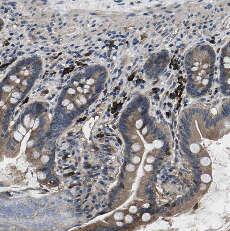 PLEC1 Antibody - BSA Free Immunohistochemistry: PLEC1 Antibody - BSA Free [NBP1-92275]