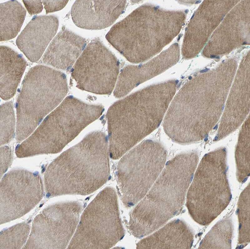 PLEC1 Antibody - BSA Free Immunohistochemistry: PLEC1 Antibody - BSA Free [NBP1-92275]