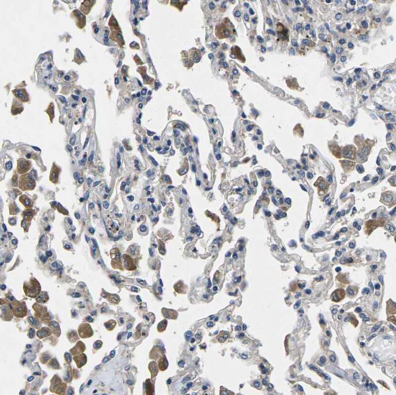 PLEC1 Antibody - BSA Free Immunohistochemistry: PLEC1 Antibody - BSA Free [NBP1-92275]
