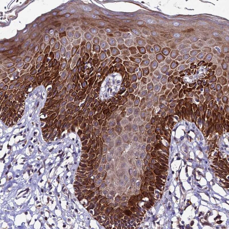 Plxdc2 Antibody - BSA Free Immunohistochemistry: Plxdc2 Antibody - BSA Free [NBP1-92278]