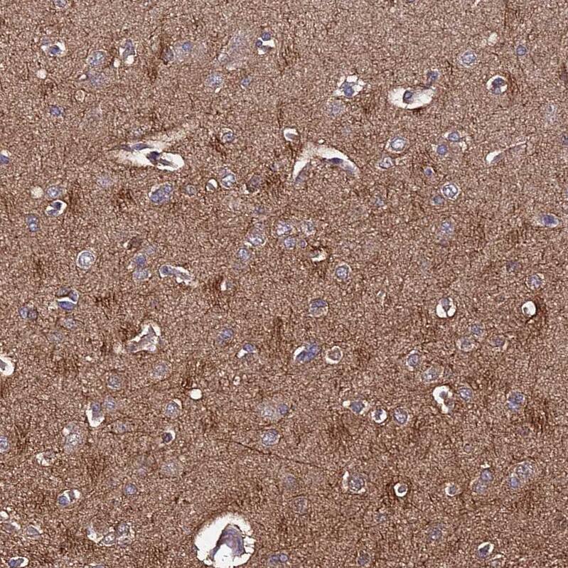 Plxdc2 Antibody - BSA Free Immunohistochemistry: Plxdc2 Antibody - BSA Free [NBP1-92278]