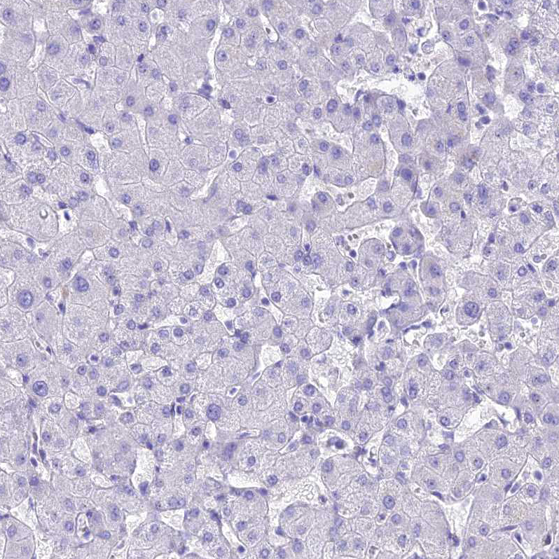 PrPC Antibody - BSA Free Immunohistochemistry: PrPC Antibody - BSA Free [NBP1-92285]