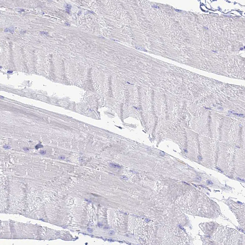 PrPC Antibody - BSA Free Immunohistochemistry: PrPC Antibody - BSA Free [NBP1-92285]