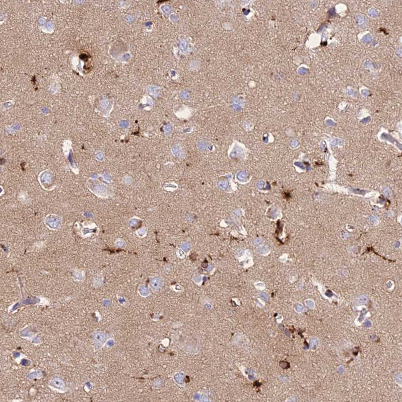 PrPC Antibody - BSA Free Immunohistochemistry: PrPC Antibody - BSA Free [NBP1-92285]