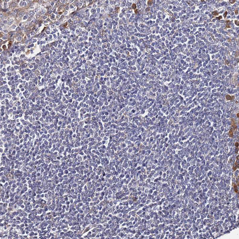 AMPK beta 2/PRKAB2 Antibody - BSA Free Immunohistochemistry: AMPK beta 2/PRKAB2 Antibody - BSA Free [NBP1-92286]